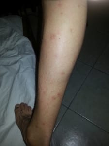 Week #1 4 muggen in curacao